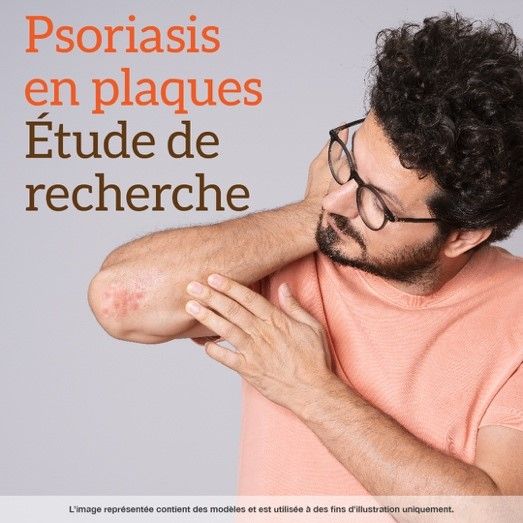 étude clinique en cours pour le psoriasis en plaques
